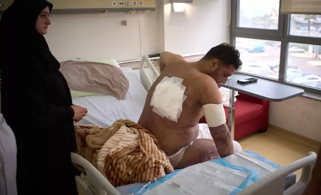 A man with burn wounds from an Israeli airstrike on southern Lebanon sits on a bed at the Sidon Government Hospital in Sidon, Lebanon, Thursday, April 2, 2026. (AP Photo/Emilio Morenatti)