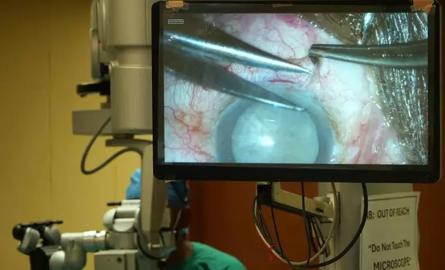 A monitor displays a live cataract surgery during a surgical marathon, in Tsakane, South Africa, Saturday, March 28, 2026. (AP Photo/Kayleen Morgan)