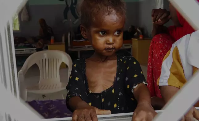 Four-year-old Farhia, who is suffering from severe acute malnutrition, looks through a window at a hospital in Qardho, Puntland, Somalia, Friday, April 17, 2026. (AP Photo/Jack Denton)