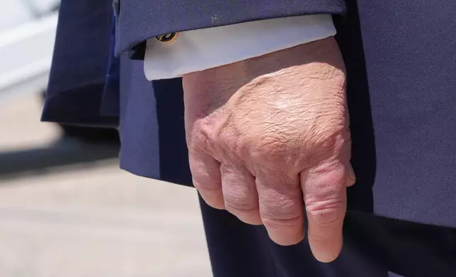 President Donald Trump's right hand is seen as he speaks to the press after returning and stepping off Air Force One, Wednesday, May 20, 2026, at Joint Base Andrews, Md., after speaking at the U.S. Coast Guard Academy commencement. (AP Photo/Jacquelyn Martin)