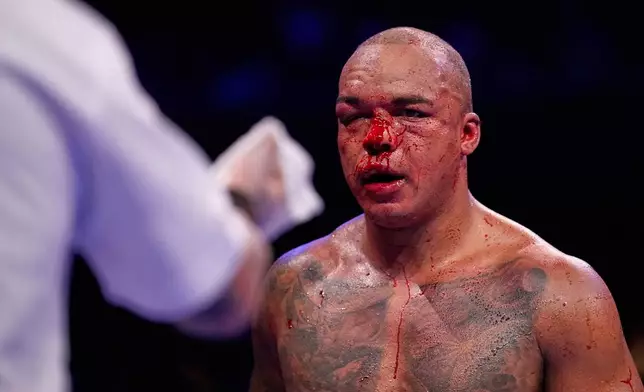 Britain's Fabio Wardley walks back to his corner bloodied by Britain's Daniel Dubois during their WBO World Heavyweight boxing title bout in Manchester, Saturday, May 9, 2026. (AP Photo/Dave Thompson)