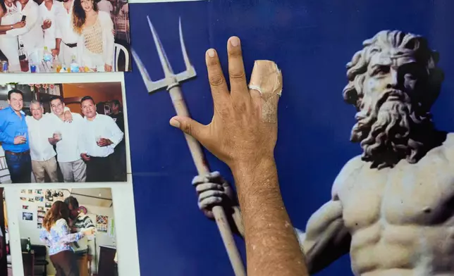 Ivan Diaz, a money lender, shows his hand with fingers he says were amputated by kidnappers who abducted him and later released him after a ransom was paid, in Trujillo, Peru, Thursday, May 21, 2026. (AP Photo/Rodrigo Abd)