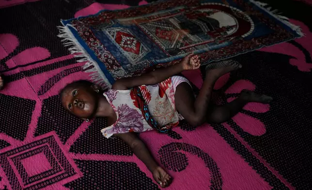 Farisa, who has relapsed into malnutrition, plays on a mat inside her house in Kware Sokoto, northwestern Nigeria, Wednesday, July 15, 2026. (AP Photo/Sunday Alamba)
