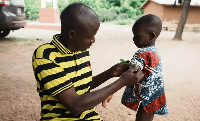 Douro Wonkourou Idrissou, who described himself as a nutrition support member, uses a tape to measure the circumferences of a child's upper arm, in N'dali, northern Benin, Sunday, May. 17, 2026. (AP Photo/Sunday Alamba)