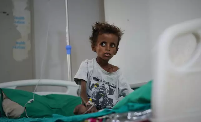Tarek al-Salami, 7, who was displaced from the city of Mokha and is showing symptoms of malnutrition, sits on a bed while receiving treatment at a therapeutic feeding center in Buraiqa, on the western outskirts of Aden, Yemen, Tuesday, Sept. 22, 2026. (AP Photo/Abdulnasser Alseddik)