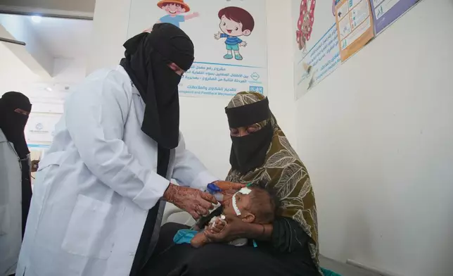 A health worker treats a child showing symptoms of malnutrition as a woman holds the child at a therapeutic feeding center in Buraiqa, on the western outskirts of Aden, Yemen, Tuesday, Sept. 22, 2026. (AP Photo/Abdulnasser Alseddik)