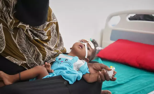 A woman holds a child showing symptoms of malnutrition while the child receives treatment at a therapeutic feeding center in Buraiqa, on the western outskirts of Aden, Yemen, Tuesday, Sept. 22, 2026. (AP Photo/Abdulnasser Alseddik)