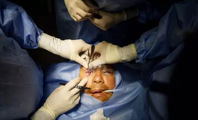 Stuart Seiff, a U.S. oculoplastic surgeon, with Ukrainian colleagues perform surgery on the eye of wounded soldier Mykola Kasiuk at a hospital in Kyiv, Ukraine, Monday, Sept. 28, 2026. (AP Photo/Evgeniy Maloletka)