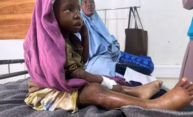 Halima Abdullahi Ibrahim sits with her 3-year-old daughter Asho Hassan Abdi, in a stabilization center in Kismayo, Somalia, Tuesday, Sept. 22, 2026. (AP Photo/Farah Abdi Warsameh)