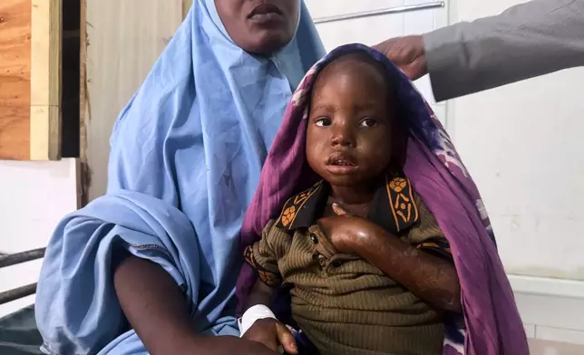 Halima Abdullahi Ibrahim holds her 3-year-old daughter Asho Hassan Abdi, in a stabilization center in Kismayo, Somalia, Tuesday, Sept. 22, 2026. (AP Photo/Farah Abdi Warsameh)