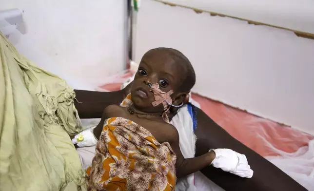 Hawa Ali holds her son Ramadan Osmanin, who is suffering from malnutrition, in Kimanyo general hospital in Kismayo, Somalia, Tuesday, Sept. 22, 2026. (AP Photo/Farah Abdi Warsameh)
