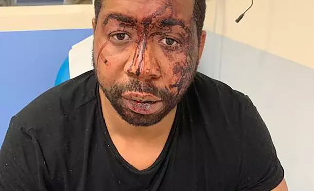 黑人澤萊被數名警員毆打。AP
