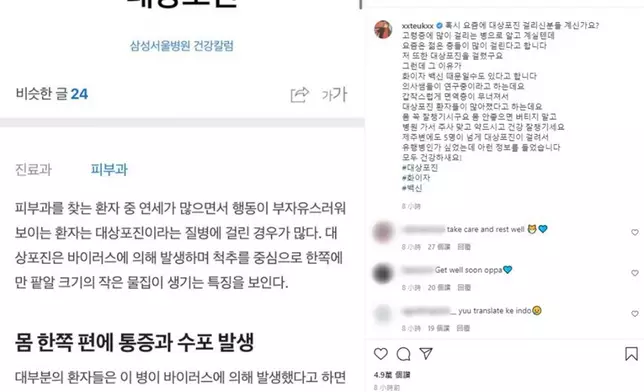 利特自爆患上帶狀皰疹（網上圖片）