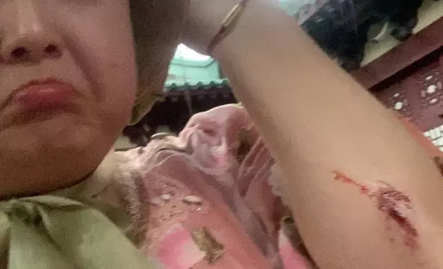 小寶真係仆到流晒血架，有圖有真相！