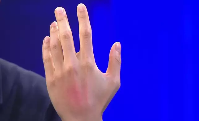 隻手真係紅咗一撻架！