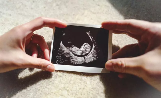 袁偉豪與張寶兒於今年6月公布懷孕的喜訊。