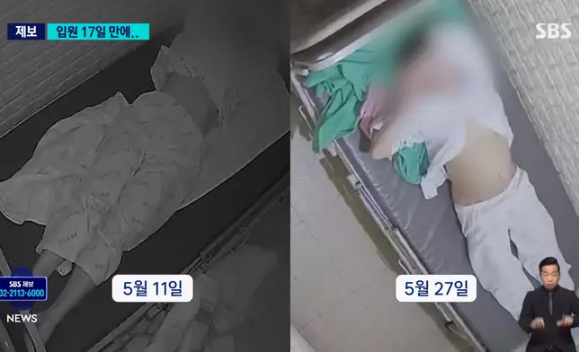 女病人入院17日後死亡（影片截圖）