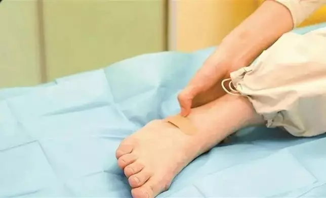 女子因右腳背持續疼痛求醫。網上圖片