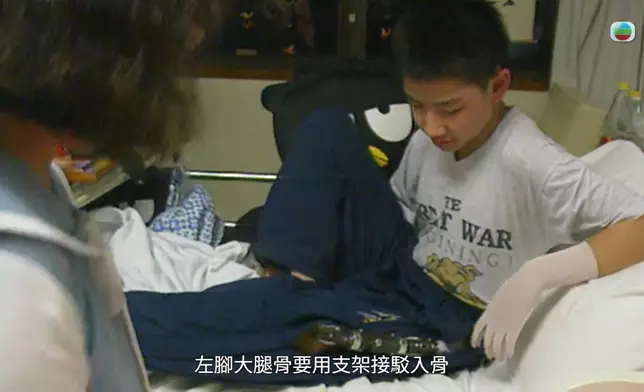 李雋文當年的康復之路很漫長。