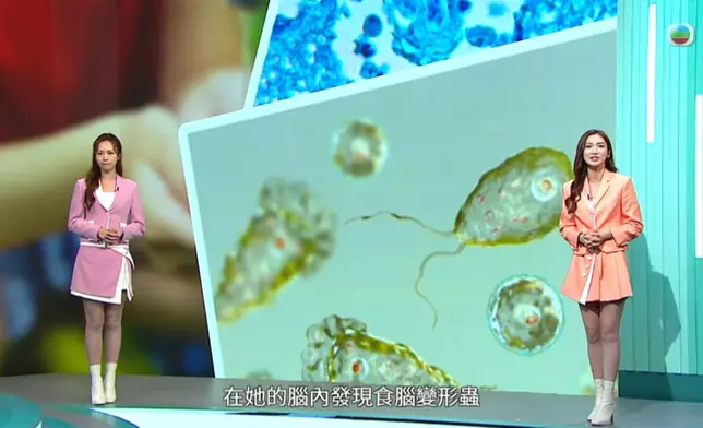 昨晚另一頭條：美國有一名婦人因用了露營場地提供的自來水洗臉，遭「食腦變形蟲」入侵，最終感染腦炎死亡。