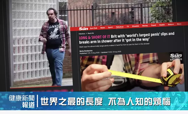 今晚其中一則新聞，倫敦一名41歲男子擁有14吋半巨型生殖器，成為世界之最的同時，亦因而釀成意外。