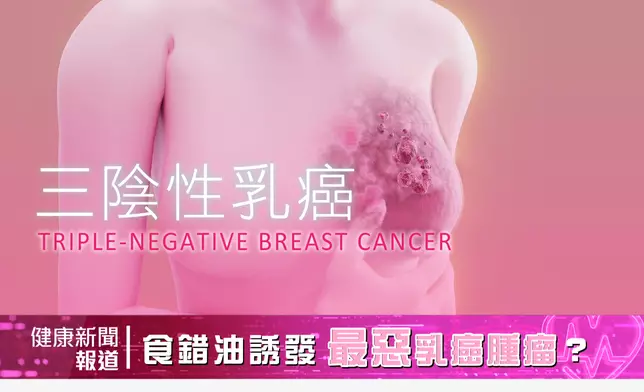 美國一間大學最新醫學研究，「食錯食用油」可能加速三陰性乳癌腫瘤生長。