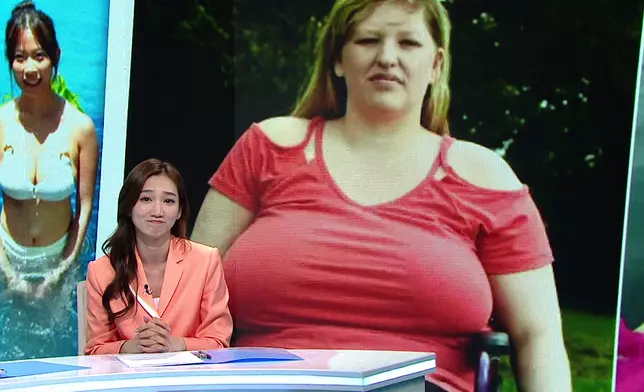 另一則重點新聞，是英國一名擁有42L巨胸的女子，曾因彎腰拾物時突感背部劇痛，當場倒地，送院後證實脊椎嚴重受損。