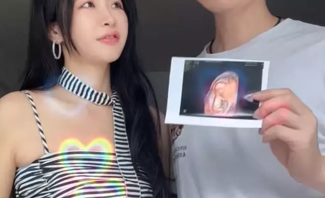 目前已經懷孕7個月。