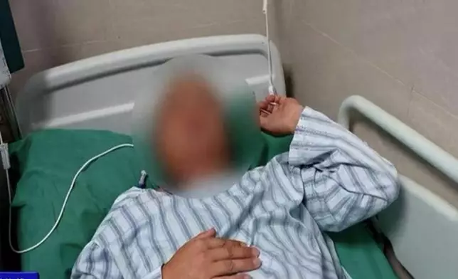 湖南漢突發抽搐口吐白沫就醫揭腦內潛藏18CM寄生蟲。影片截圖