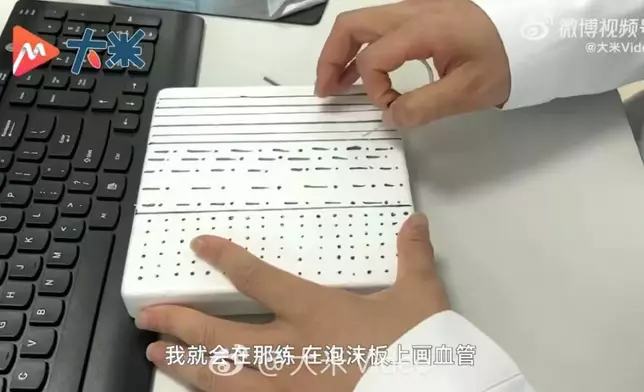 檢驗技士為減輕患者抽血痛感苦練「飛針」， 最快0.6秒見血回流。影片截圖