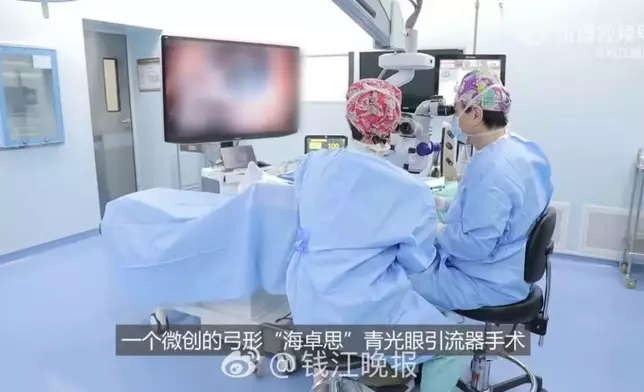 內地醫生施白內障飛秒激光聯合青光眼三重引流微創手術助患者重拾清晰視力。影片截圖