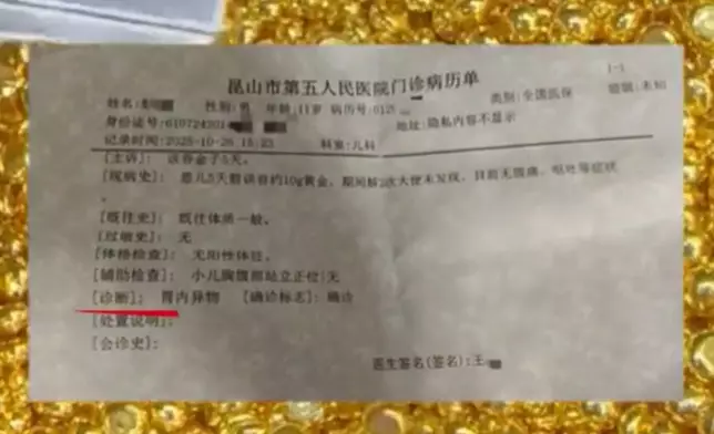 11歲男童為「練舌頭」誤吞10克金豆，排便5日於就醫當日終順利排出。影片截圖