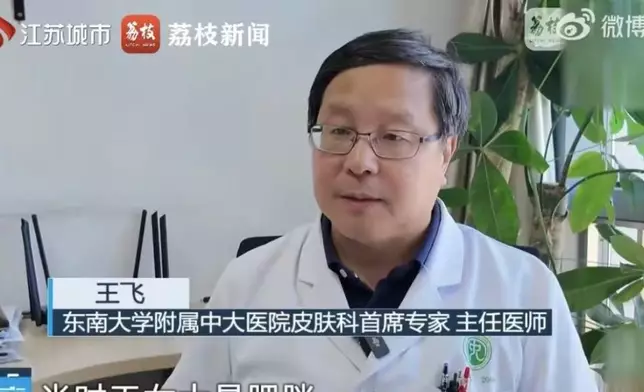 女子誤信「純中藥神膏」塗抹10年致全身佈滿紫紅色蛇紋患腎上腺衰竭。影片截圖