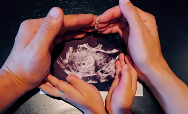 二人於今年五月宣布即將迎來第二胎。