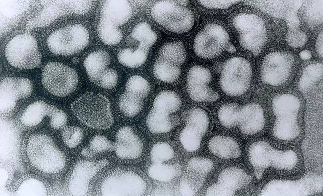 顯微鏡下的甲型流感病毒。CDC圖片