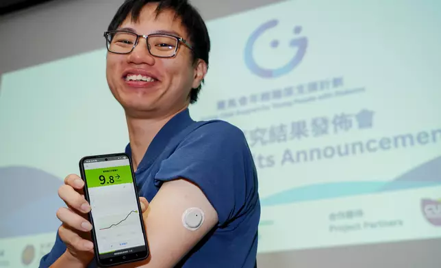 有別於「篤手指」驗血糖，糖尿病患者可透過「連續血糖監測儀」檢測，只需配載感測器，連接其他儀器後，可監測血糖水平。中大醫學院圖片