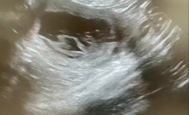 產前做足準備，定期去獸醫處來查做超聲波。海關FB影片截圖