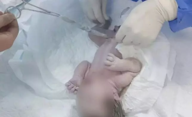 女子懷孕近10月渾然不覺，腹痛求醫僅23分鐘誕下男嬰。影片截圖