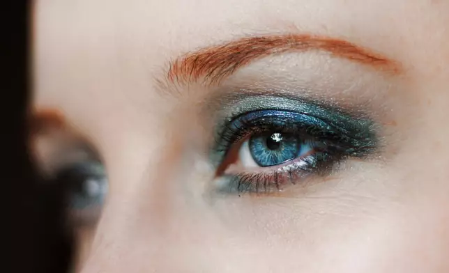 女子長期卸妝不徹底導致睫毛毛囊藏6條蠕形蟎蟲。資料圖片