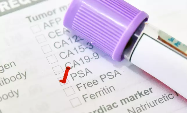 透過簡單的抽血檢驗，醫生可測量血液中的PSA濃度，作為評估前列腺健康的重要指標 。Getty設計圖片