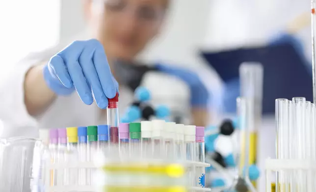 泌尿科專科醫生指出，當PSA指數升至此水平，意味著前列腺細胞出現異常活躍或破壞。雖然高指數不一定等於確診癌症，但「超過10」絕對是極強烈的警訊。Getty設計圖片