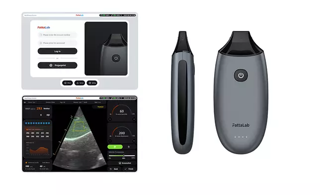 「FattaLab®肝臟脂肪測量儀」獲得「數碼健康」組別「創新獎」。
