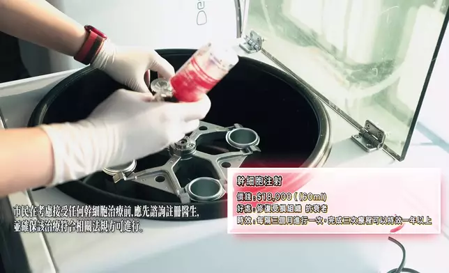 黃梓瑋體驗貴婦級的幹細胞注射及透明質酸填充。