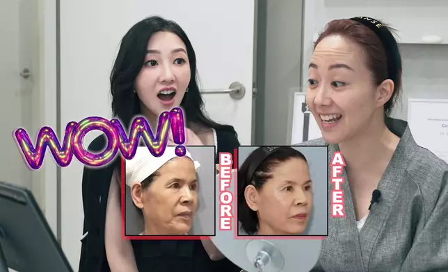 「韓版彭于晏」院長展示母親做機前後的照片。