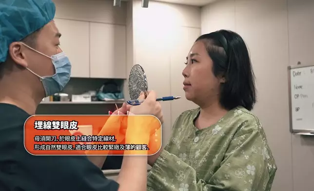 Alex為一了百了，進行「埋線雙眼皮」醫美。