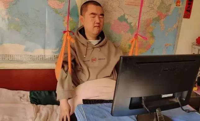 遼寧90後癱瘓作家用全身僅一隻能動的手指寫600首歌詞登上央視。網上圖片