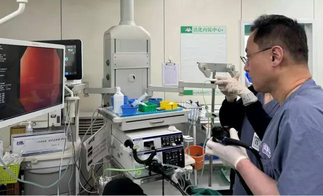 男子腹痛1周求醫揭腸道內藏兩把匙羹險造成穿孔。網上圖片