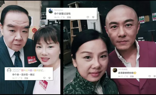 Jenny細說當年整容經歷。