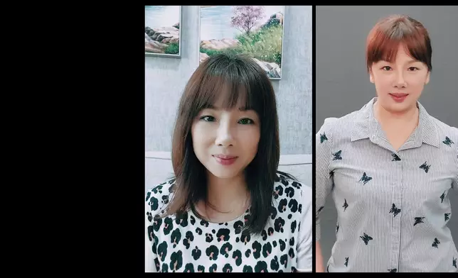 Jenny細說當年整容經歷。