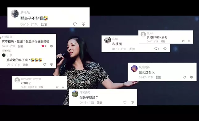 Jenny細說當年整容經歷。